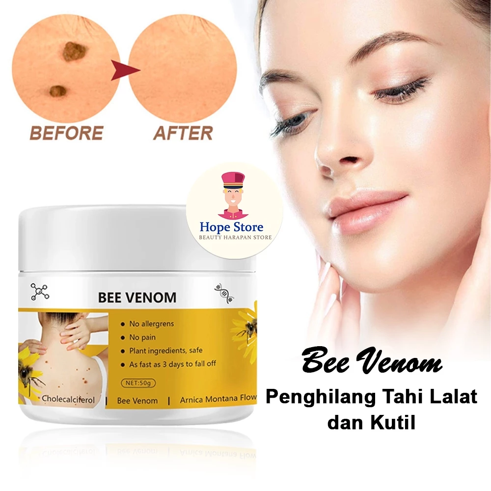 Penghilang Tahi Lalat Di Wajah Permanen Ampuh / Cream Bee Venom 50gr | AutoStock