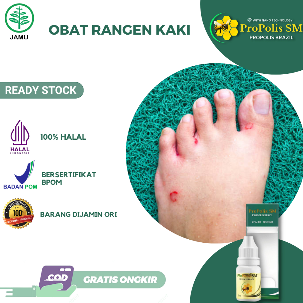 Jual Obat Rangen Kaki, Obat Gatal Gatal Kaki, Kutu Air di Kaki, Obat ...