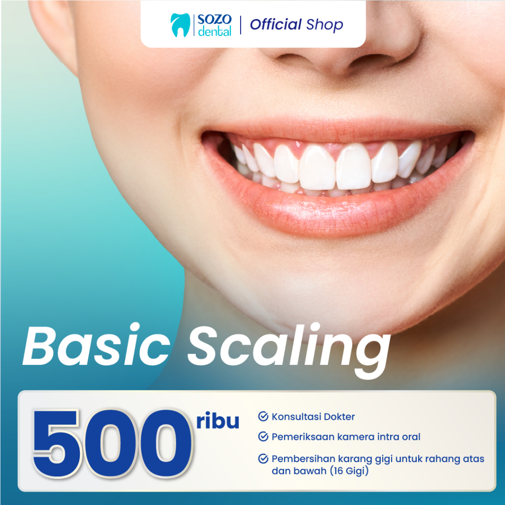 Jual Basic Scaling / Pembersihan Karang Gigi Basic + Konsultasi Dokter ...
