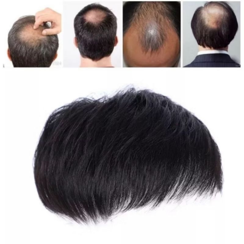 Jual TOUPEE BOTAK PRIA KOREA/TOUPEE PENUTUP BOTAK MODERN/WIG PENUTUP ...
