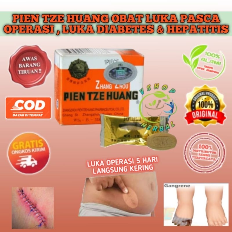 Jual ORIGINAL - BINAHONG PTH OBAT LUKA OPERASI , LEVER & HEPATITIS ...