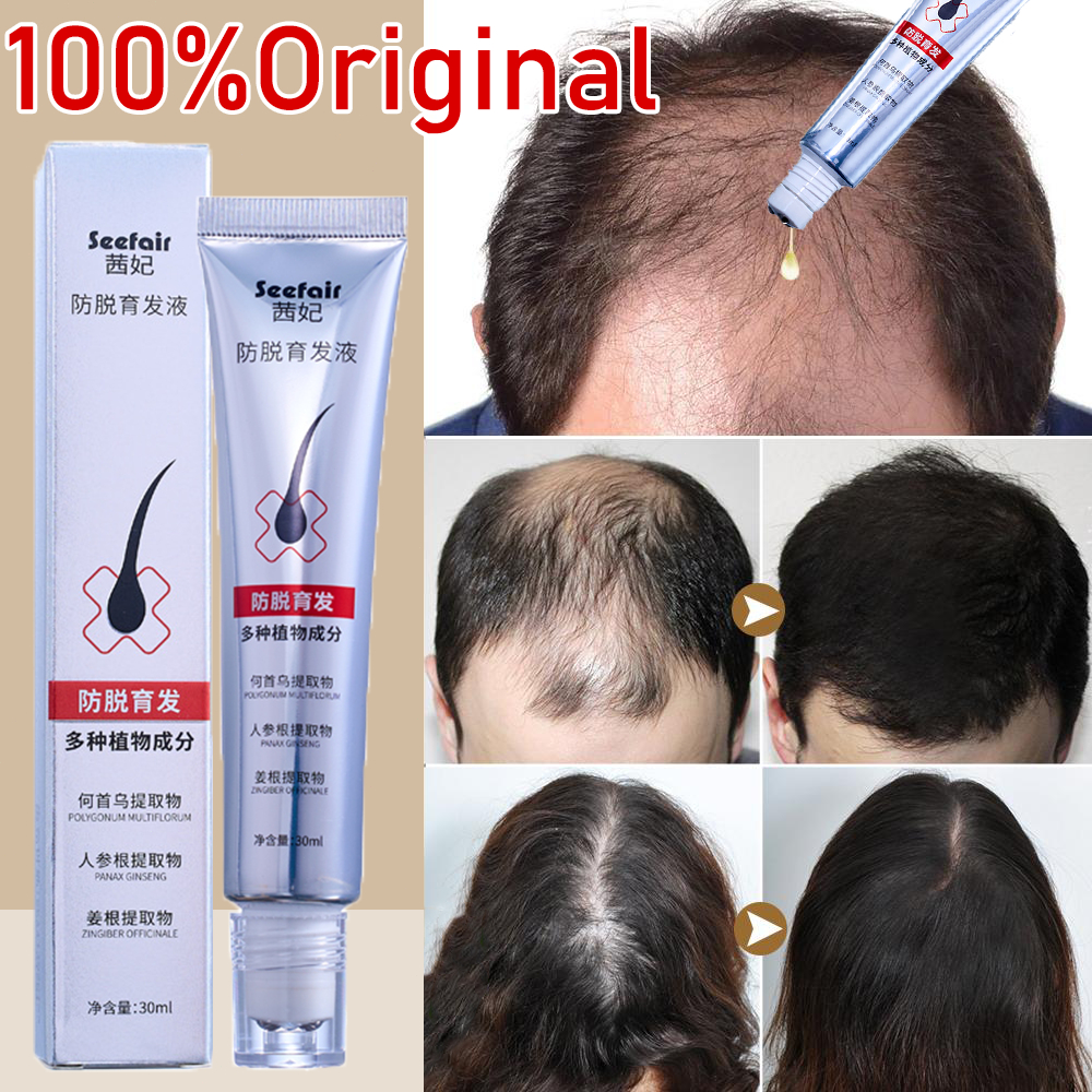 Jual Penumbuh rambut cepat dan tebal Serum penebal rambut Perawatan ...