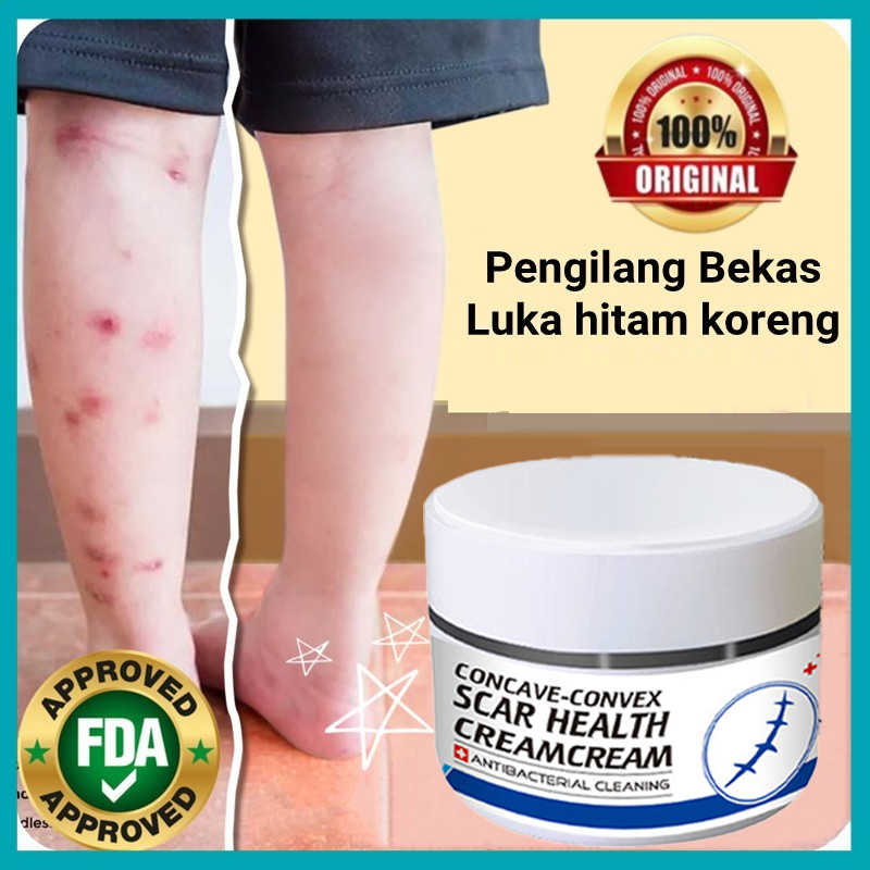 Jual Salep Penghilang Bekas Luka Hitam Koreng Menghilangkan Bekas Luka