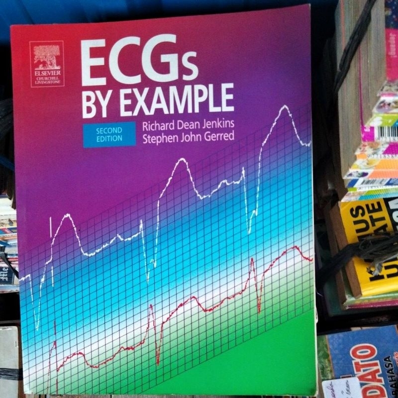 Jual ECHs(BY EXAMPLE) | Shopee Indonesia