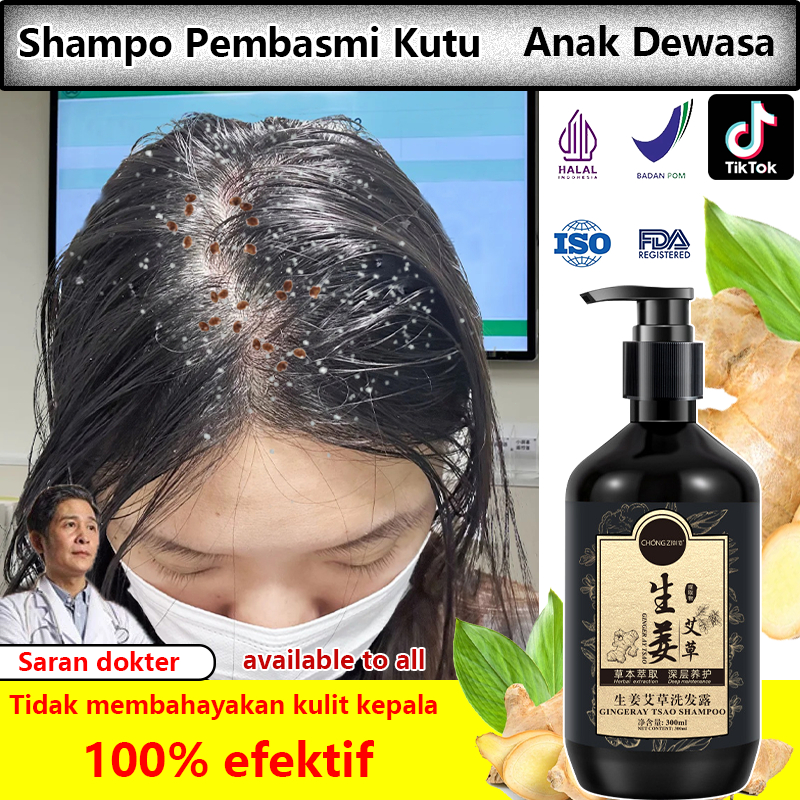 Jual Sampo Kutu Rambut Paling ampuh untuk Anak&Dewasa 300ml / Sampo