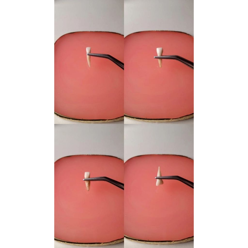 Jual Gigi Anterior Caninus Insisiv Pedo/Sulung RA RB | Shopee Indonesia