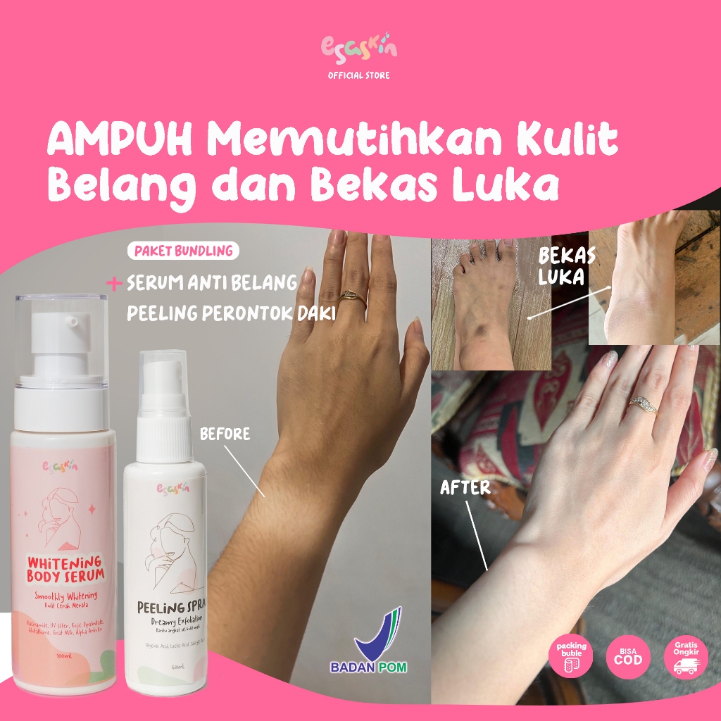 Jual ESASKIN - Peeling Spray dan Body Serum | Shopee Indonesia