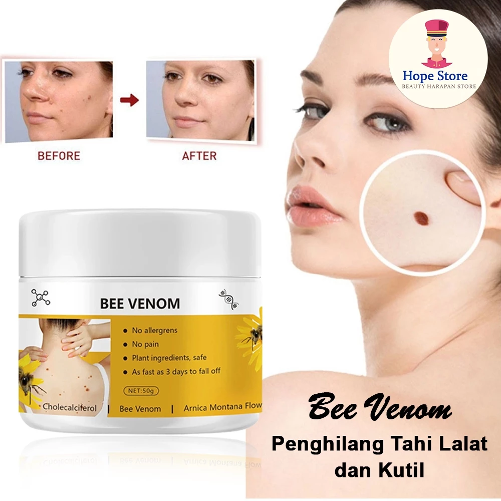 Cream Bee Venom 50gr Krim Penghilang Tahi Lalat Melembabkan Kulit Tanpa Rasa Sakit | AutoStock