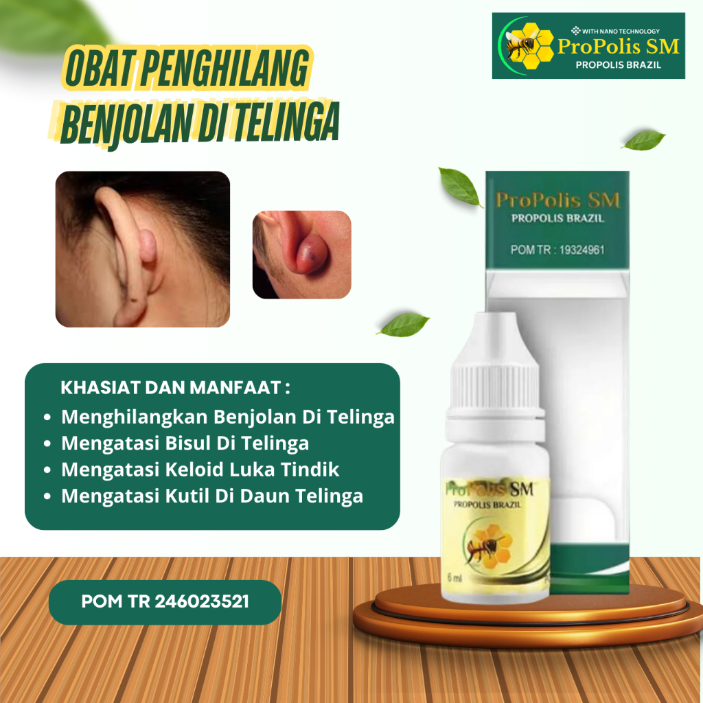Jual Obat Penghilang Benjolan Di Telinga, Benjolan Di Belakang Telinga