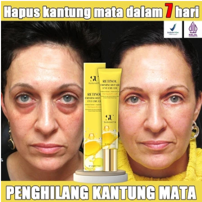 Jual SUSUVETA Retinol Eye Cream Menghilangkan Kantung Mata Dan Kerutan ...