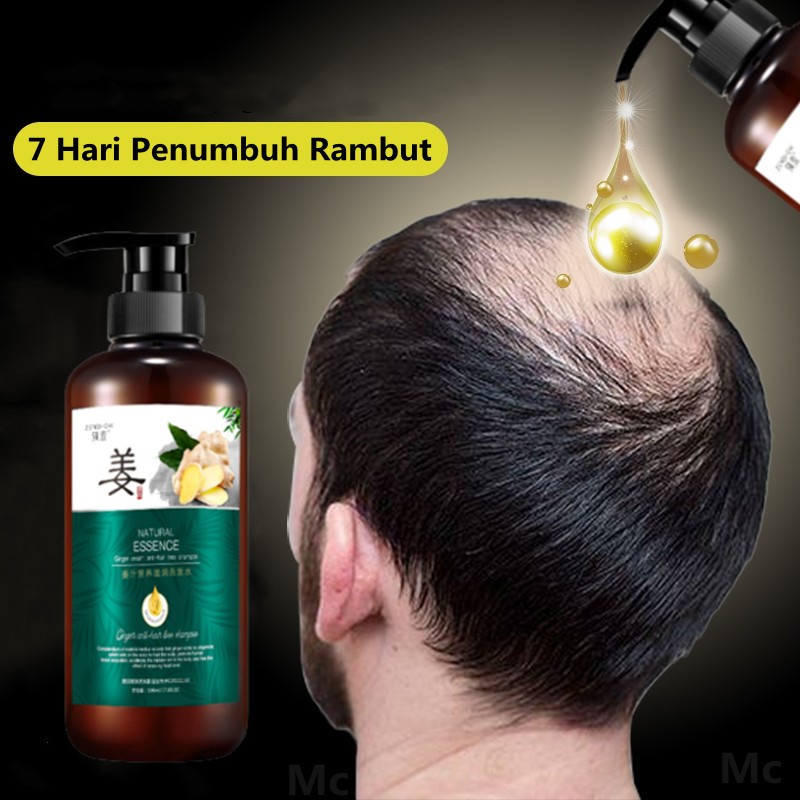 Jual Sampo Penumbuh Rambut Cepat Shampo Rambut Rontok Shampo Jahe Hair ...