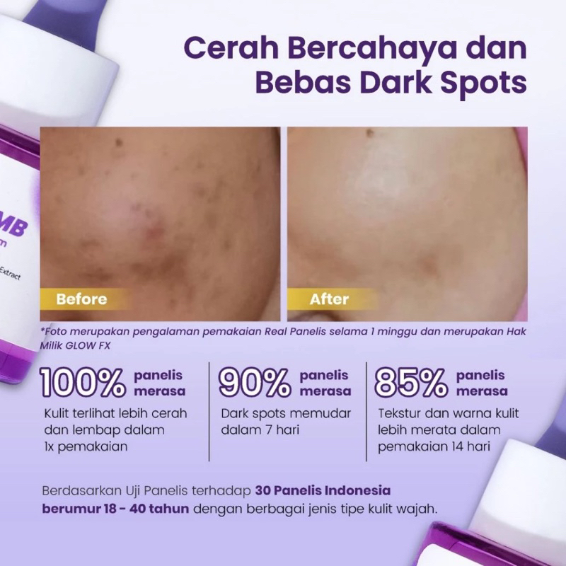 Jual GURLS - GLOW FX Acne Pure & Glow Bomb Serum 20ml | Glow Fx Rice ...