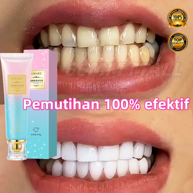 Jual 【ORIGINAL】pasta gigi pemutih gigi kuning 100g perontok karang