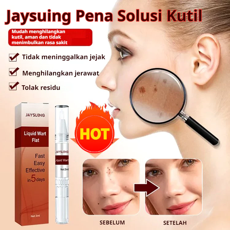Wart Removal Cream