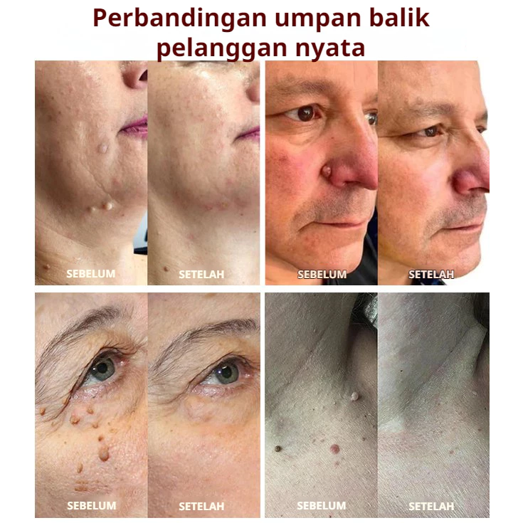 Hasil Sebelum dan Sesudah