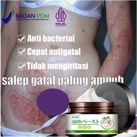 Jual Salep Gatal Obat Gatal Kulit Salep Eksim Dermatitis Jamur Anti ...