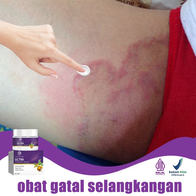jual-obat-gatal-selangkangan-obat-kurap-salep-gatal-china-paling-ampuh