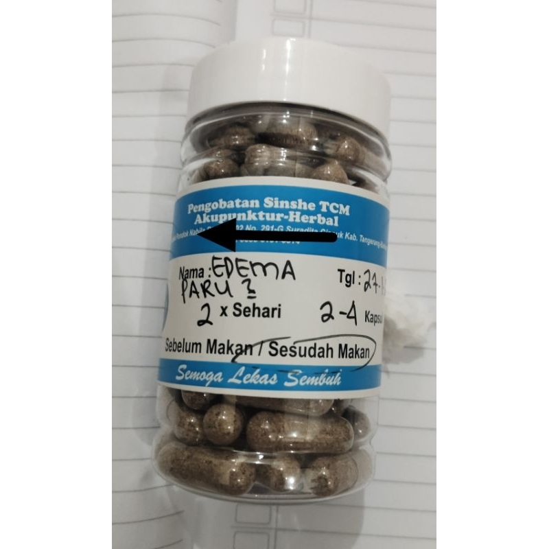 Jual Jamu Herba Ramuan Edema Paru -Asites Racikan Sinshe | Shopee Indonesia