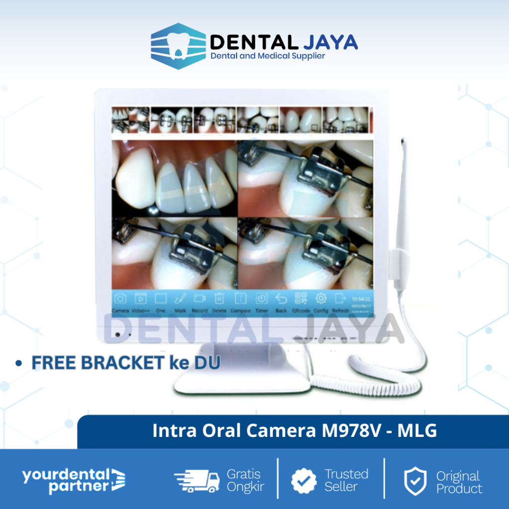Jual MLG Intra Oral Camera M978V Free Bracket Du | Shopee Indonesia