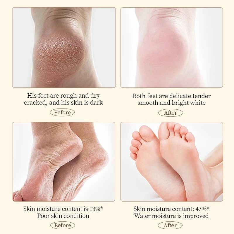 Collagen Foot Cream 60g Krim Kaki Pecah Dan Kering Kasar Ampuh 100% Perbaikan An - foto 4