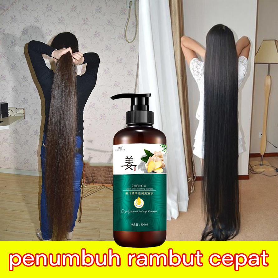 Jual Sampo penumbuh rambut cepat Ginger shampoo penumbuh rambut botak ...