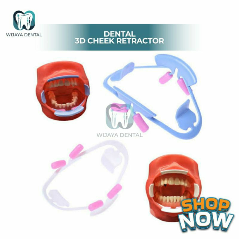 Jual DENTAL CHEEK RETRACTOR 3D / DENTAL MOUTH OPENER 3D / DENTAL ...