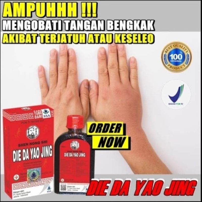 [BPOM] Die Da Yao Jing 30ml | Obat Merah China, Luka, Keseleo