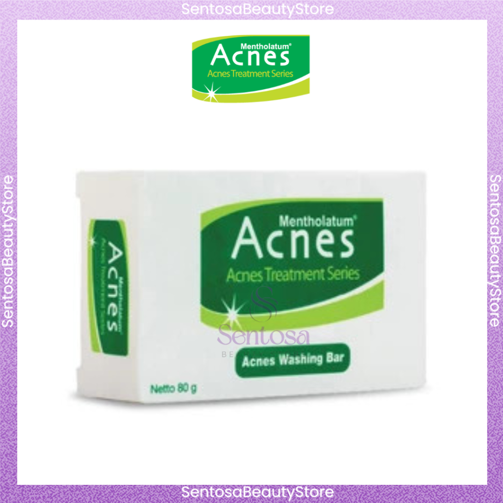 Jual Acnes Washing Bar 80gr (Reduce & prevent redness of the skin due