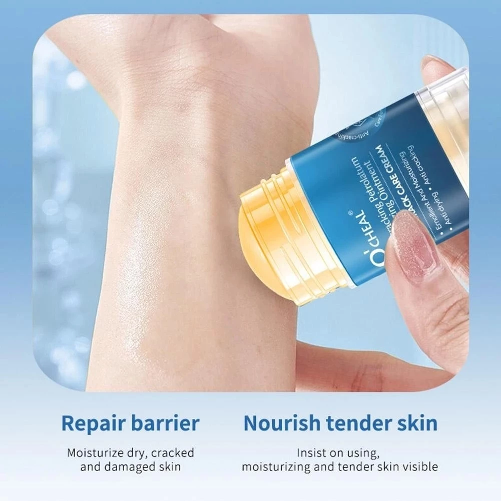 Ocheal Vaseline Cream Kaki Tangan Kering Kapalan | AutoStock