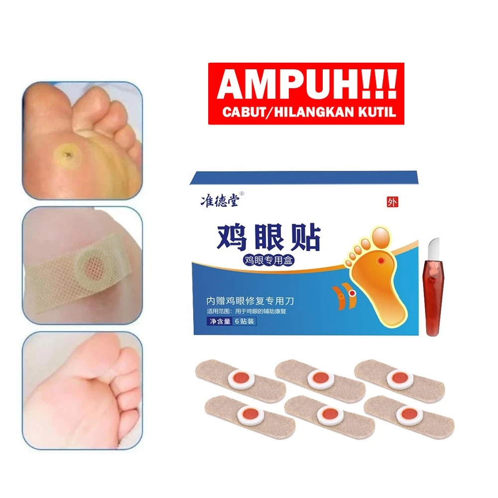 Plester Penghilang Kutil / Kapalan / Penghilang Mata Ikan / Foot Corn Removal - Isi 6Pcs | AutoStock