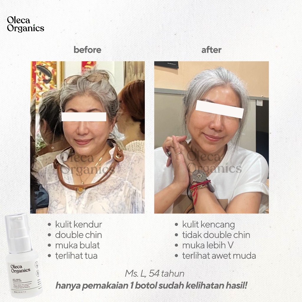 Jual Oleca Organics Neck and Chin Lifting Gel – Atasi Double Chin ...