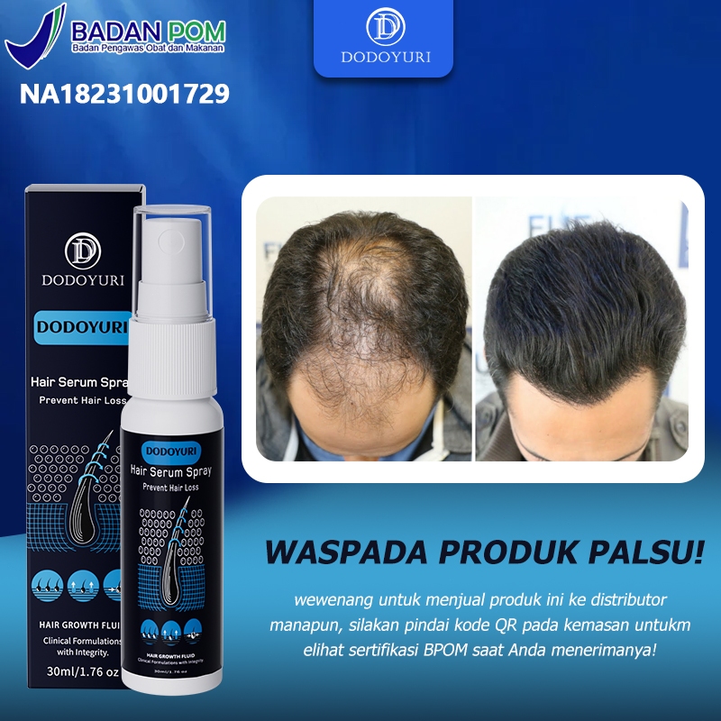 Jual DODOYURI Serum penumbuh rambut Penumbuh rambut botak Hair tonic ...