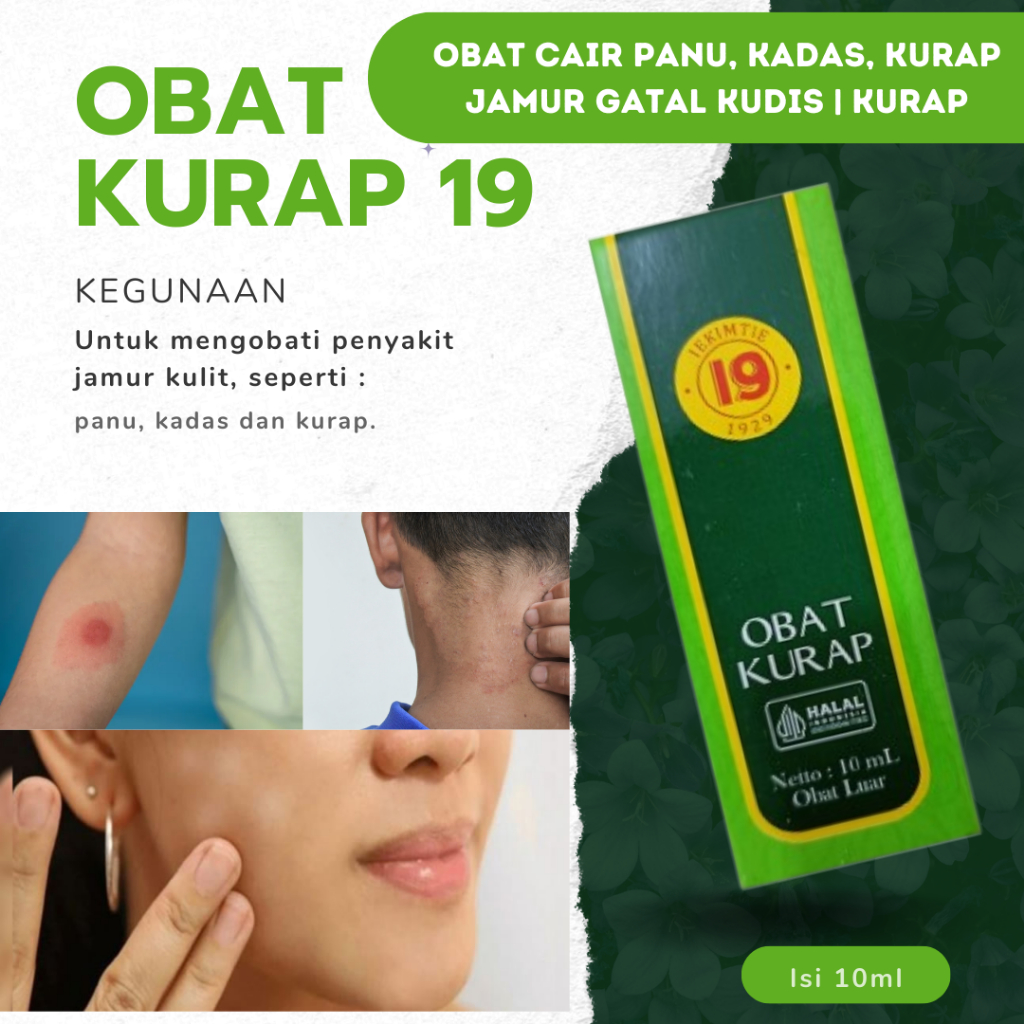 Jual Obat CAIR Panu, Kadas, Kurap Jamur Gatal Kudis | Kurap 19 10ml ...