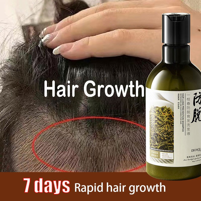 Jual [100% asli] shampoo penumbuh rambut cepat rontok 250ML Perawatan ...