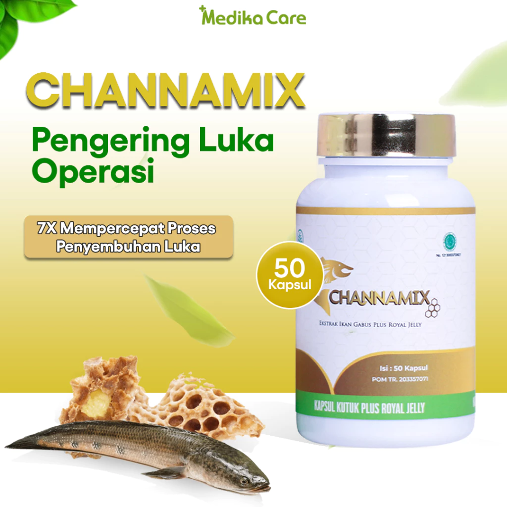 Review Channamix Obat Luka Caesar