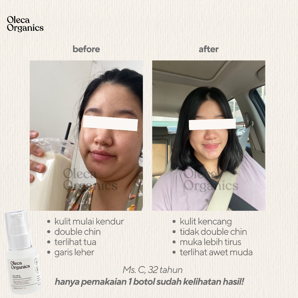 Jual Oleca Organics Neck and Chin Lifting Gel – Atasi Double Chin ...