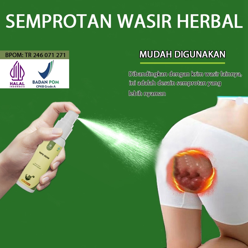 Obat wasir obat ambien salep ambeien paling ampuh salep ambeyen paling ampuh original 30ml salep wasir ampuh asli china Tipe campuran Tipe bola daging Aman dan tak menyakitkan penghilangan cepat herbal premium menghilangkan benjolan, wasir dalam