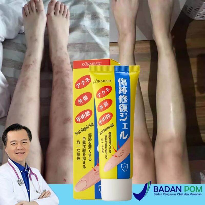 Jual Obat Bekas Luka Penghilang Bekas Luka Koreng Advanced Scar Gel 40g