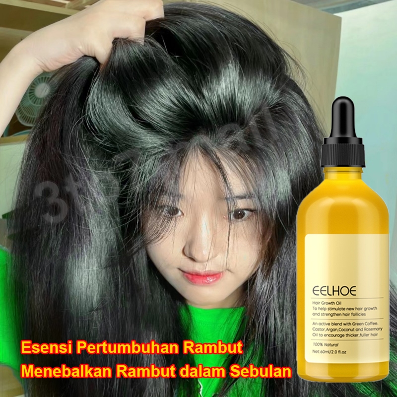 Jual COPSIYEE ROSMERY OIL UNTUK RAMBUT PENUMBUH RAMBUT SERUM PENUMBUH ...