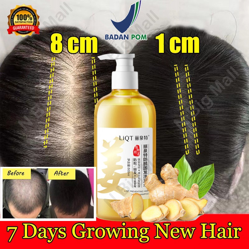 Jual Sampo penumbuh rambut cepat Shampoo anti ketombe dan rontok