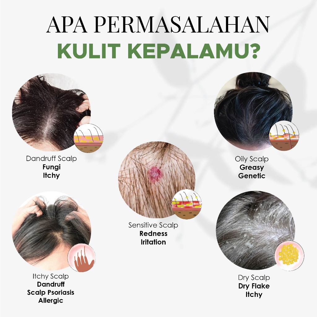 Jual Tavas Wat-Ter Scalp Shampoo Rambut Rontok atau Kulit Kepala Kering ...