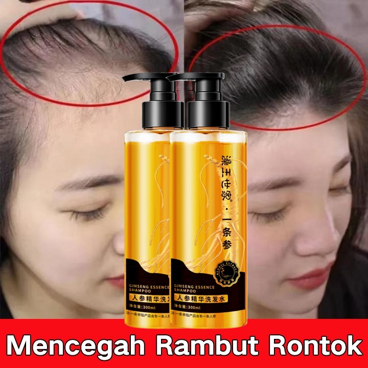 Jual Natur Shampoo Ginseng 300ml Shampo Penumbuh Rambut Cepat ...