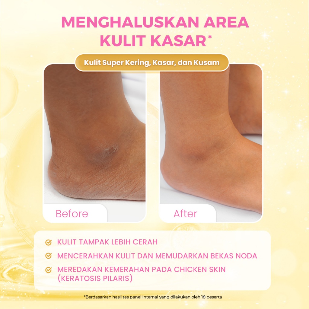 Jual Scarlett Whitening Intense Brightening AHA Body Serum 5% AHA BHA ...