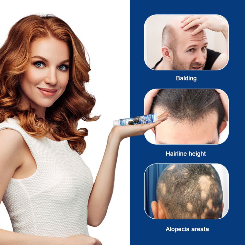 Jual Obat Alopecia Areata, Obat Penumbuh Rambut Botak, Obat Botak Koin ...