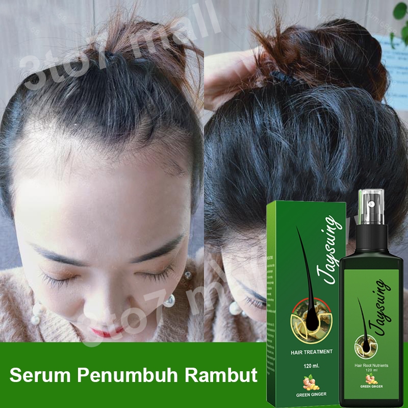 Jual serum penumbuh rambut hair growth spray Obat penumbuh rambut ...