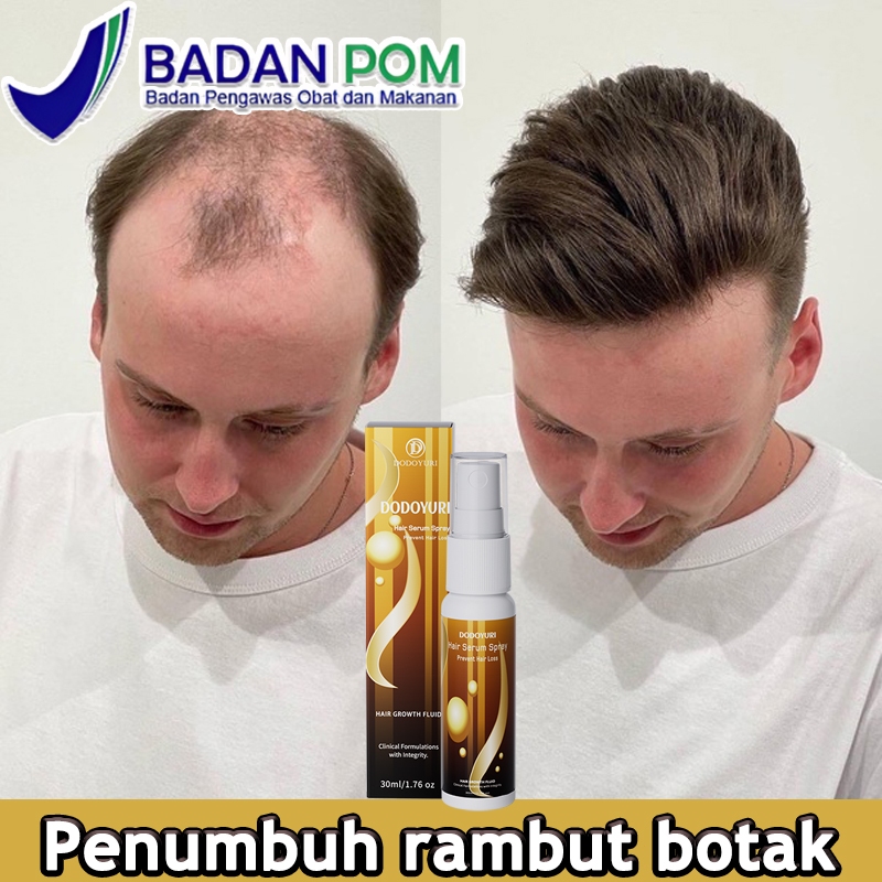 Jual Penumbuh rambut cepat penebal rambut Penumbuh rambut botak 30ml ...