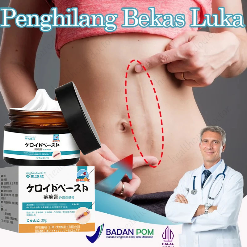Jual Scar Remover Cream 50g Penghilang Bekas Luka Koreng Advanced Scar ...