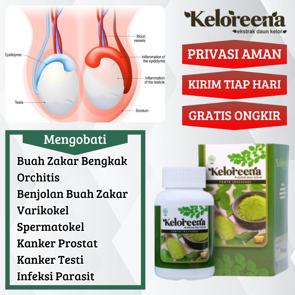 Denni Fenton erotik rasmlar