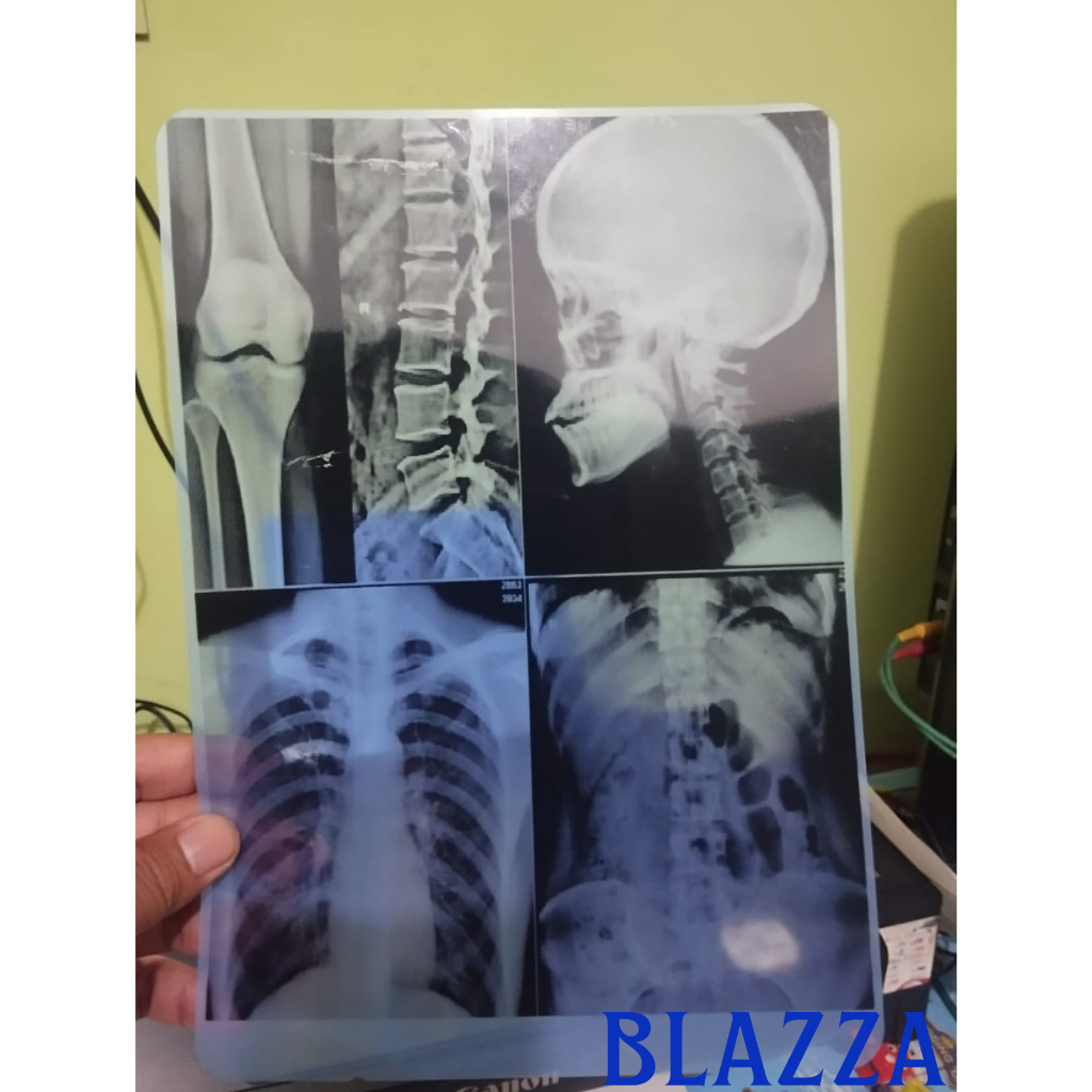 Jual Cetak Film Radiologi Medical Rontgen X-RAY A4 | Shopee Indonesia