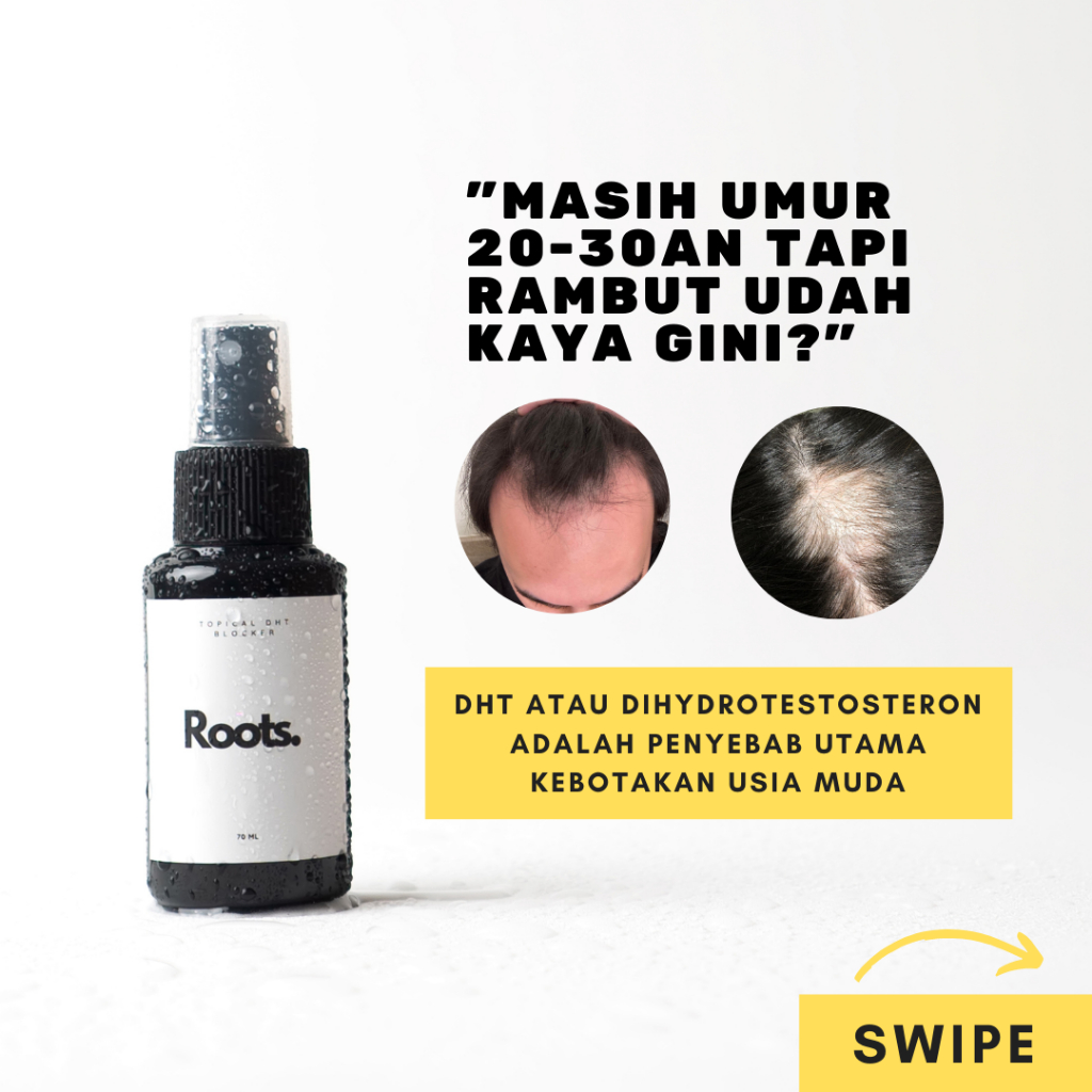 Jual Serum DHT Blocker Rambut Rontok ROOTS 70 ML | Shopee Indonesia